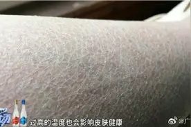 转发收藏！4个小妙招处理皮肤干痒图片
