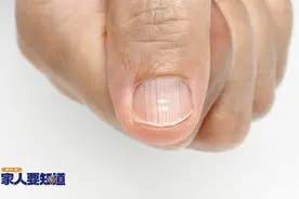 指甲起竖纹是肠胃不好？指甲“月牙”越多越健康？真相是……图片