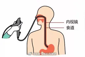 胃镜检查前，该做好什么准备？图片