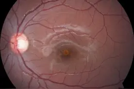 激光笔会把眼睛照瞎？不是危言耸听！图片