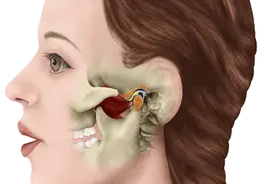 一觉睡醒，嘴巴竟张不开了？！你可能得了这种病图片