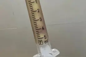 8.8元网购打耳洞神器依教程操作，女孩耳垂肿至半根香蕉大图片