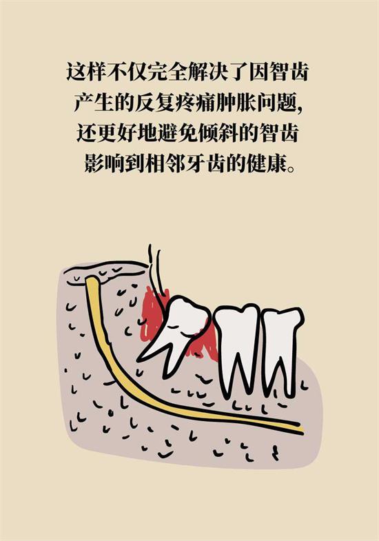 经常出现牙龈肿痛、上火，请注意这些问题！