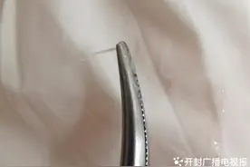 鱼刺卡喉莫慌张，郑州市九院医生用喉镜找到“凶手”图片