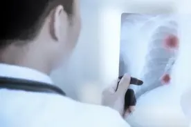 为何肺癌爱“找”同一家人图片