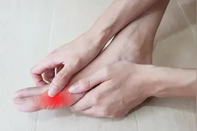 世界痛风日｜越来越年轻化的痛风：并非发作才治疗图片