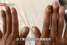 双手出现这些表现，恐是疾病信号，别再忽视了！图片