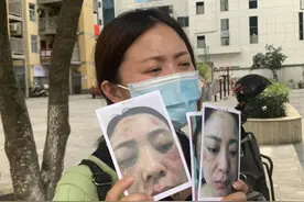 小里帮忙|祛斑后面部红烂近两年，美容店负责人：已转交第三方修复图片