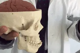 90%的脑震荡被漏诊了，你很可能也得过……图片