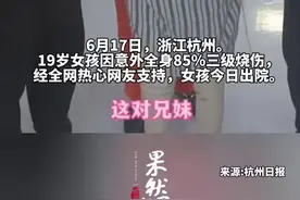 大家帮助过的烧伤女孩今日出院，主治医生讲诉哥哥照顾妹妹历程，“特别懂事得到捐助后也不乱花钱”图片