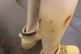 游客在四川瓦屋山徒步时遇野猴扑咬，景区回应：愿承担责任图片