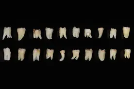 科普口腔｜智齿疼了怎么办？图片