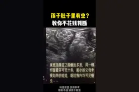 #孩子 肚子里有虫？教你不花钱判断#蛔虫 视频封面