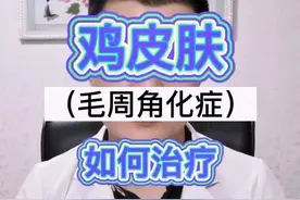 鸡皮肤就这样治#转给身边人 #关注刘医生 #健康养生知识科谱