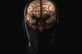 蝶骨嵴脑膜瘤切除术 #神经外科 #显微手术 #脑膜瘤 #微创