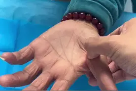 腱鞘炎#医学科普视频封面